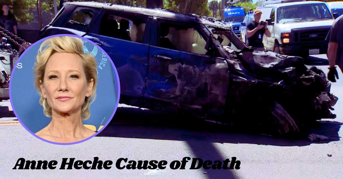 Anne Heche Cause of Death