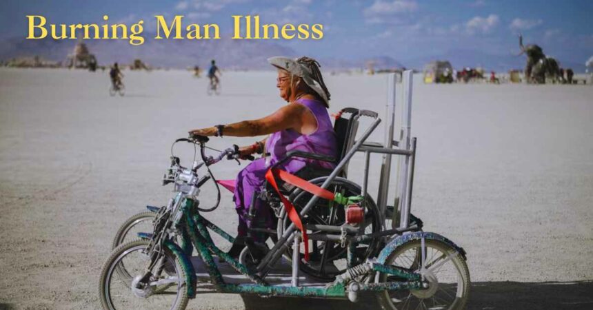 Burning Man Illness