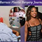 Kandi Burruss Plastic Surgery