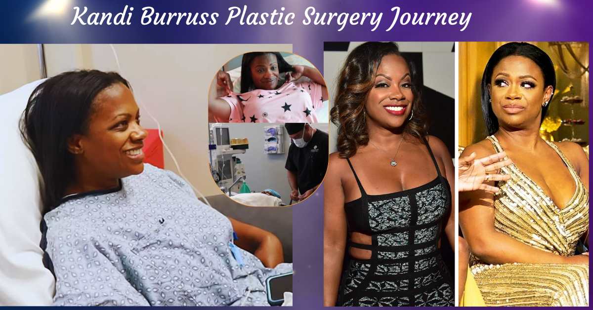 Kandi Burruss Plastic Surgery