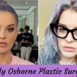 Kelly Osborne Plastic Surgery