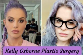 Kelly Osborne Plastic Surgery