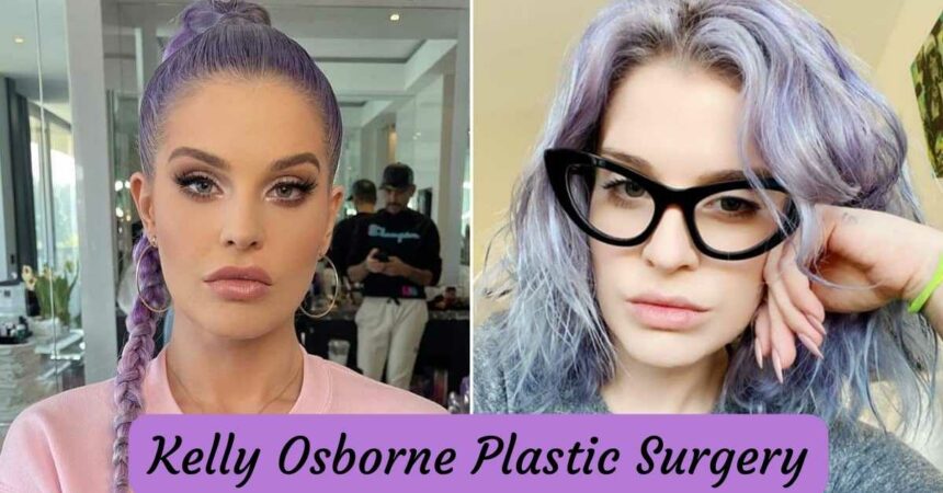 Kelly Osborne Plastic Surgery