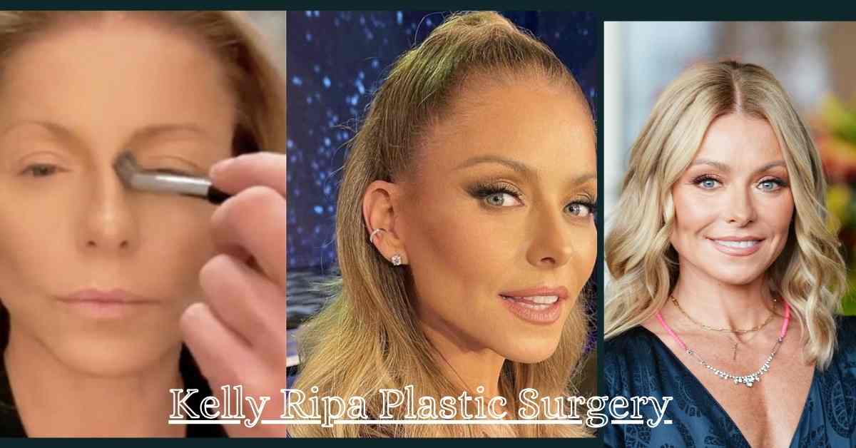Kelly Ripa Plastic Surgery