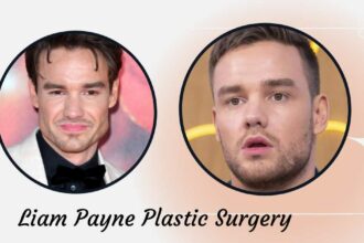 Liam Payne's Plastic Surgery