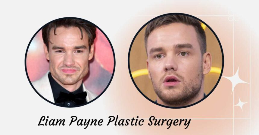 Liam Payne's Plastic Surgery