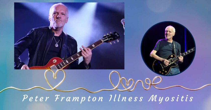 Peter Frampton Illness Myositis