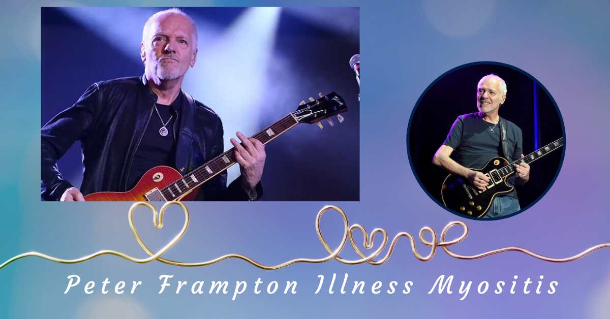 Peter Frampton Illness Myositis Journey From Diagnosis to Inspiration