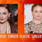 Sophie Turner Plastic Surgery