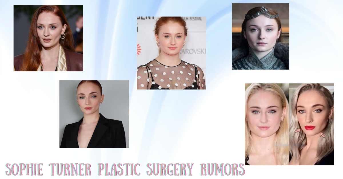 Sophie Turner Plastic Surgery Rumors