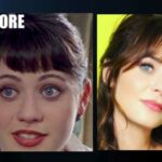 Zooey Deschanel Plastic Surgery