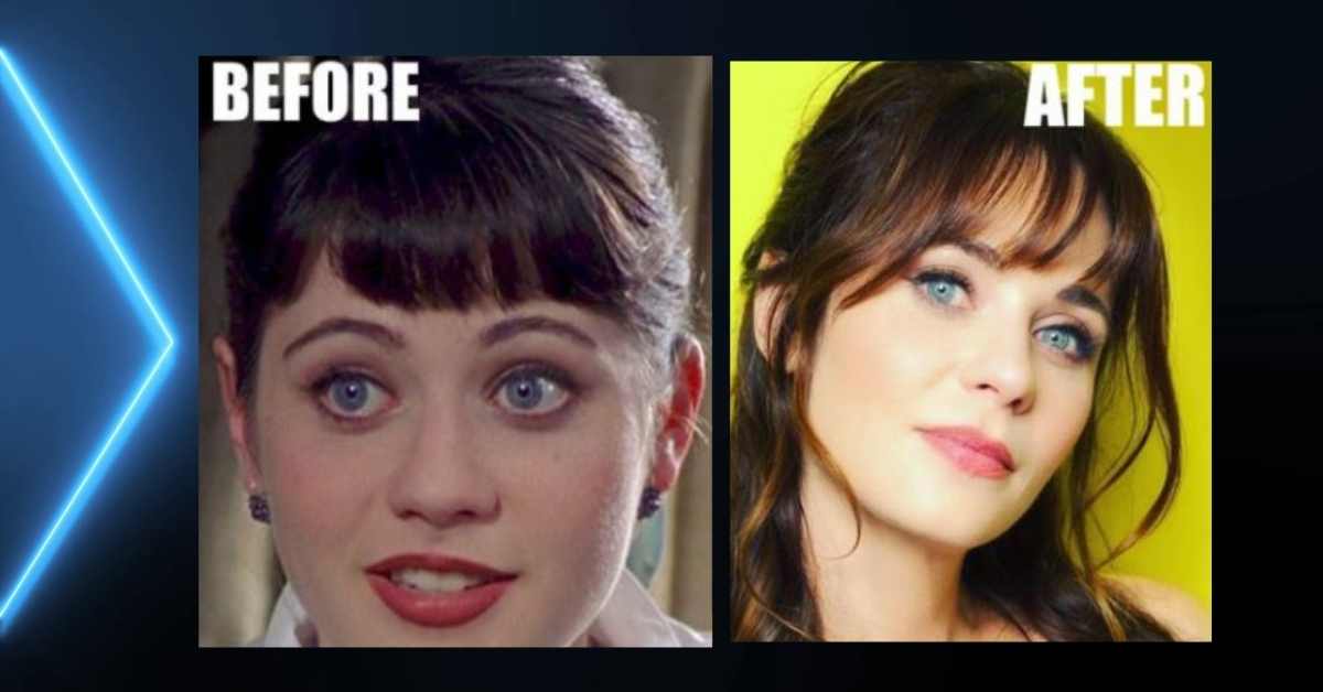 Zooey Deschanel Plastic Surgery