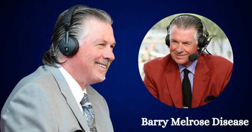 Barry Melrose Disease