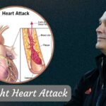 Mark Richt Heart Attack