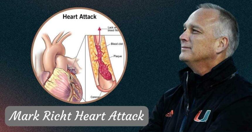 Mark Richt Heart Attack